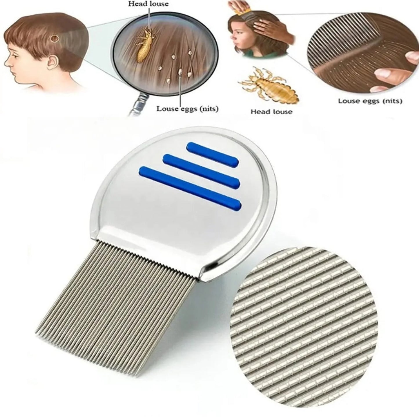2-Pack Flea & Lice Comb for Dogs & Cats – Stainless Steel Grooming Tool for Tear Stain Removal & Dematting, Ideal for All Pet Sizes